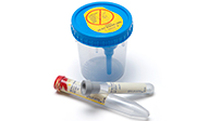 BD Vacutainer® Urine Collection System